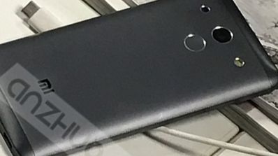 Carcasa del Xiaomi Mi5
