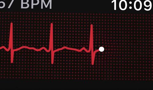 ECG en Apple Watch Series 4