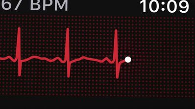 ECG en Apple Watch Series 4