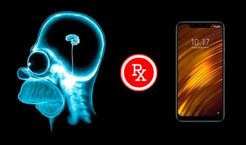 rayos x radiografia pocophone f1