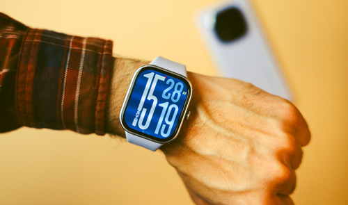 redmi watch 5 mano movil detras