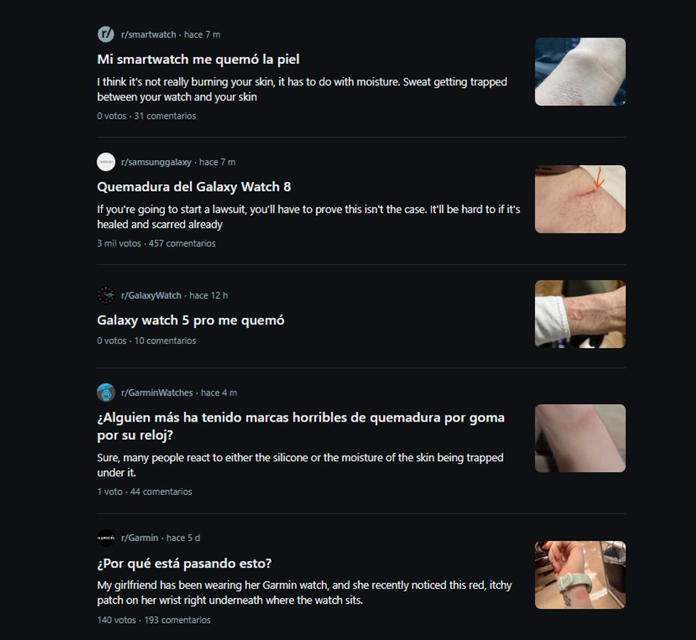 Captura de pantalla de hilos en foros de Reddit con quejas de usuarios sobre irritaciones y marcas en la piel bajo sus relojes inteligentes.